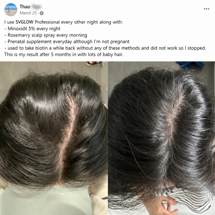 Community story