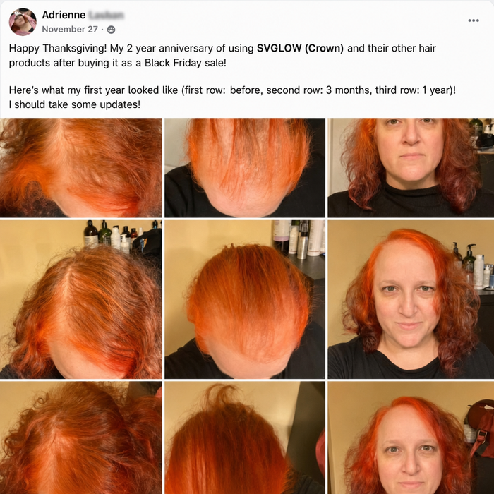 Community story