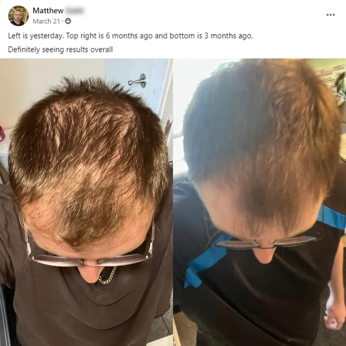 Community story